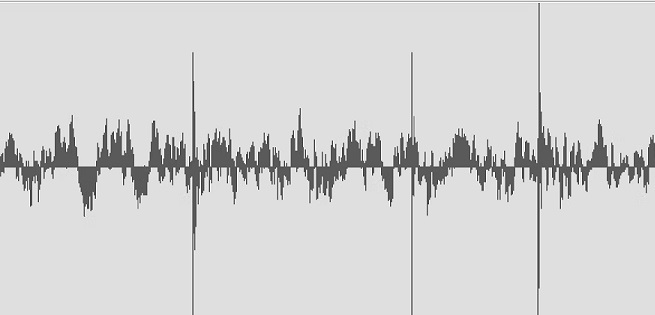 ���������� ���������� ������� � ���������: ��� �������� Click-Pop Noise Suppressors